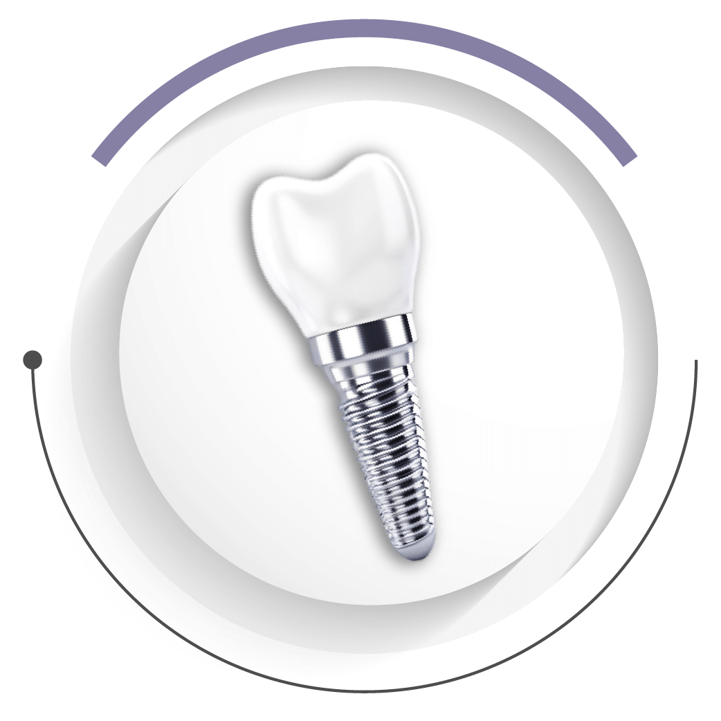 新莊開惠牙醫診所_全口重建_傳統全口植牙